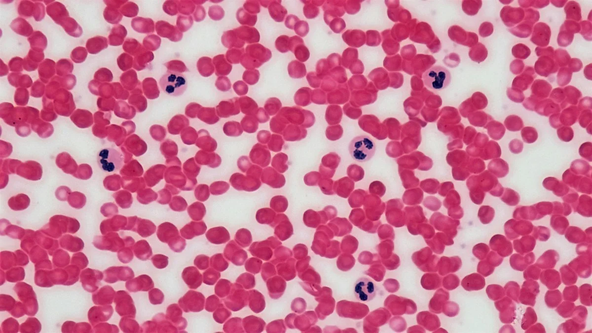 Células do sangue ao microscópio - Painel de linfoma hereditário